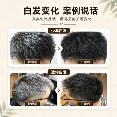 白转黑精华液乌黑滋养液滋养毛囊坚韧发根育发液防脱膏何首乌草本 - 5