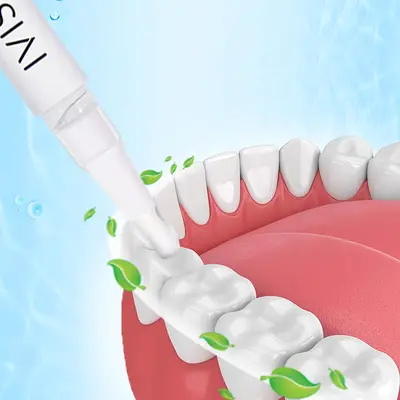 Zahnaufhellungs-Gel-Stift mit Reinigungs- und Poliereffekt - 3