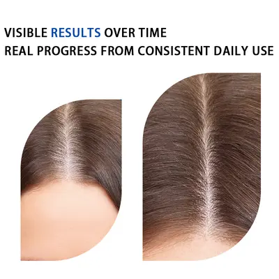 Haarserum mit Kugelapplikator, 5% Sägepalmenextrakt, DHT-Blocker - 4