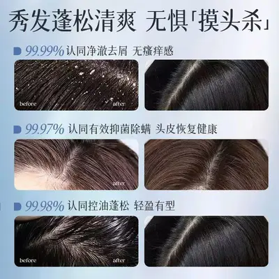Selenium Disulfide Shampoo, Anti-Dandruff, Oil Control, Volumizing - 5