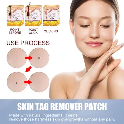 QINGPU Invisible Pimple Patches, Scar and Mole Patches, Makeup Compatible - 3