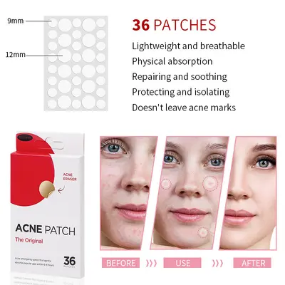 Hydrocolloid Acne Nose Patch, Blackhead and Oil Control - 3