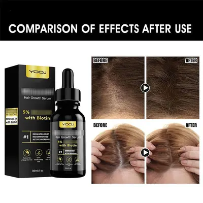 5% Hair Growth Serum, Haarpflege-Öl für geschmeidiges Haar