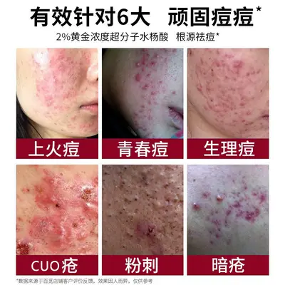Acne-clearing essence for fading marks and pore refinement