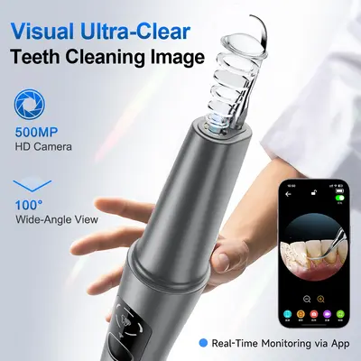 超声波洁牙器便携电动洗牙器5种模式可视超声波洁牙器去除牙结石