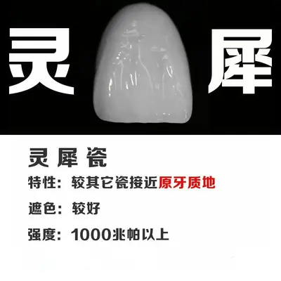 3D全瓷贴面超薄美白牙贴片蓝瓷琥珀灵犀瓷遮丑牙贴美牙修复体