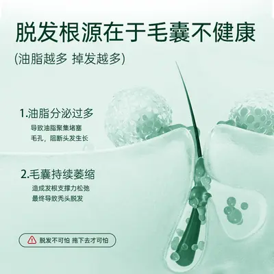 明澄雅防脱去屑洗发露爆款去屑蓬松控油防脱洗发露防脱特证洗发水