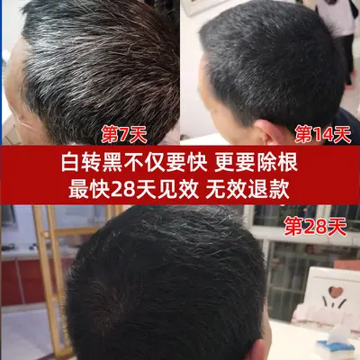 Black Ganoderma and He Shou Wu Herbal Shampoo, Darkens Gray Hair, Anti Hair Loss - 5