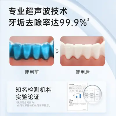 雅玺超声波冲牙器家用洗牙器水牙线便携式齿电动深度清洁源头工厂