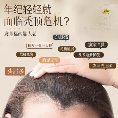 Customizable Anti-Dandruff Solid Hair Shampoo, Anti-Hair Loss - 2