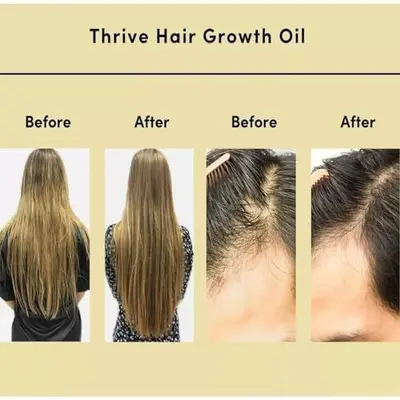 跨境爆款Natural Hair Growth Oil Veganic头发营养液育发油防脱