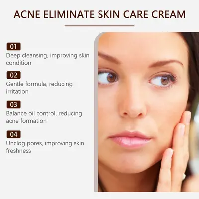 OUHOE Herbal Acne Cream, Gentle Moisturizing Facial Care - 4