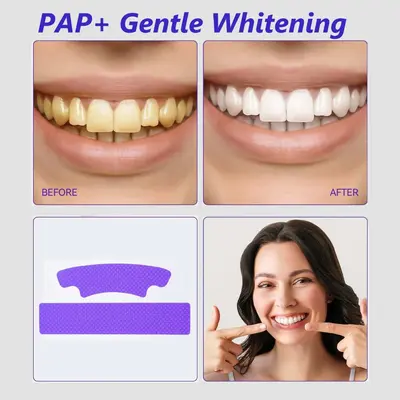 V34 Teeth Whitening Strips for Daily Gentle Care and Tooth Cleaning - 5