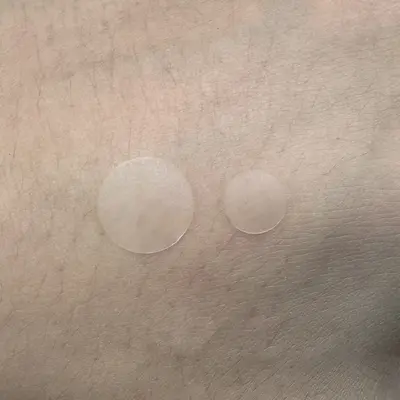 Transparent Hydrocolloid Acne Patch, Waterproof, Fades Acne Marks - 5
