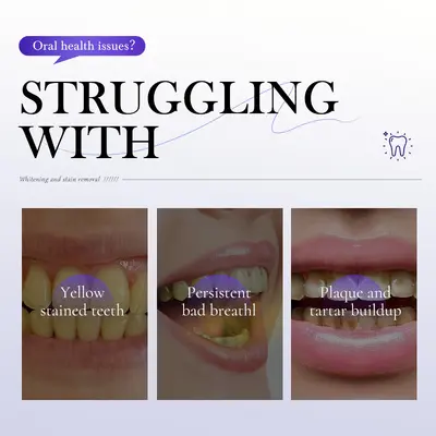 Lysozyme Whitening Toothpaste, Removes Yellowing and Bad Breath - 4