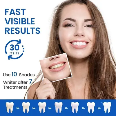 Mint-flavored teeth whitening strips that remove stains gently