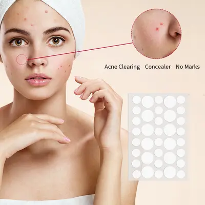 Hydrocolloid Acne Nose Patch, Blackhead and Oil Control - 5