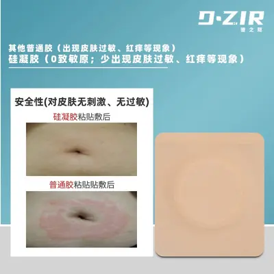 Silikon-Gel-Bauchnabel-Patch in zehn Farben, FDA-zertifiziert, leerer Akupunkturpunkt-Patch, Sanfu-Patch, Sanjiu-Patch, elastisches Gewebe mit selbstklebendem Belag.