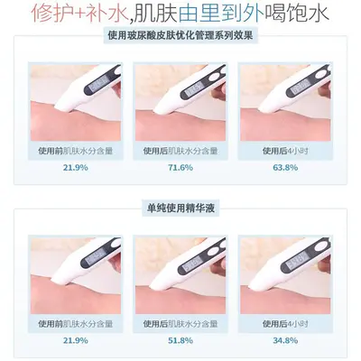 1000ml Hyaluronsäure-Serum Essenz Konzentrat tiefenwirksame Feuchtigkeitspflege Gesichtsserum porenverfeinernd Schönheitssalon-Profi