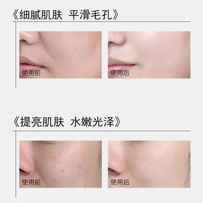玻尿酸原液水光动能素补水保湿提亮肤色美容院专供面部水光精华液