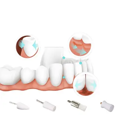 Electric tooth polisher with tartar and stain removal
