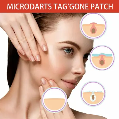 OUHOE Acne Patch, Daily Care, Breathable and Skin-Friendly - 2