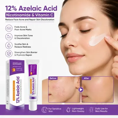 Azelaic acid 12% niacinamide acne scar remover and ointment