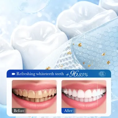 SADOER9D Teeth Whitening Strips 7 Pouches Box Bright White Teeth Strips Pairs - 4
