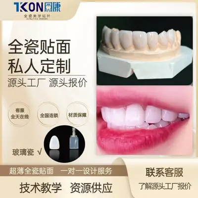 美牙全瓷贴片团队学习瓷片材料牙贴美牙玻璃瓷牙齿贴面牙齿美白 - 2