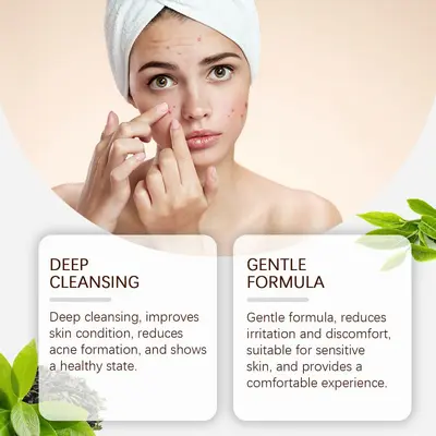 OUHOE Herbal Acne Cream, Gentle Moisturizing Facial Care - 2