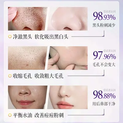 PNPN紫苏去黑头鼻贴收缩细化毛孔祛闭口粉刺深层清洁黑白头草莓鼻