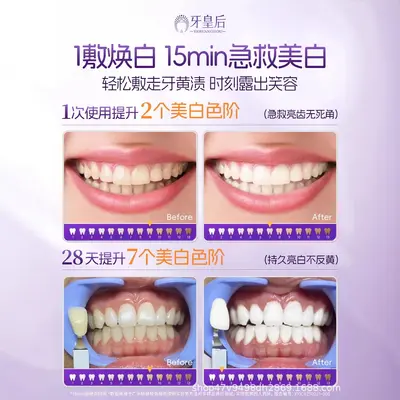 Teeth whitening strips, strong stain removal