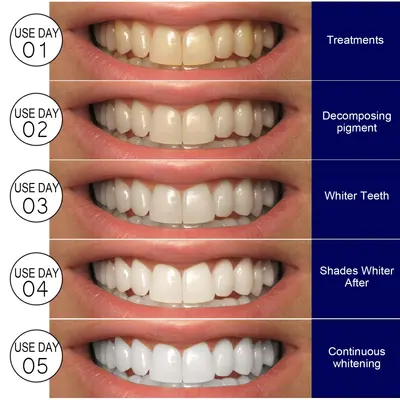 EELHOE Whitening Teeth Strips, Removes Stains and Smoke Stains - 3
