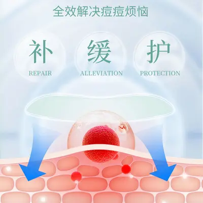 微针可溶无创痘痘贴舒缓贴片式微晶导入加速吸收日用通用祛痘印