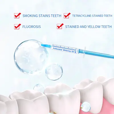 Tooth Whitening Gel Pen and Set with Oral Gel