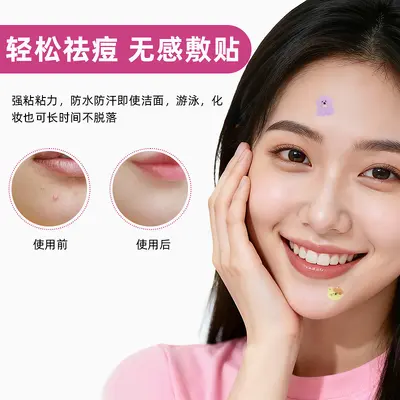 Hydrocolloid Acne Patch, Cartoon Design, Breathable - 3