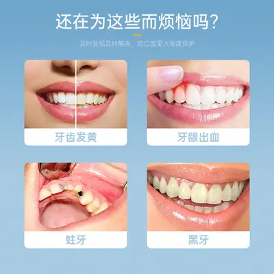 口腔内窥镜可视新款高清可视口腔仪牙镜护理清洁检牙仪牙科工具