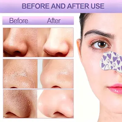 Peel-Off Blackhead Removing Nose Strips - 4