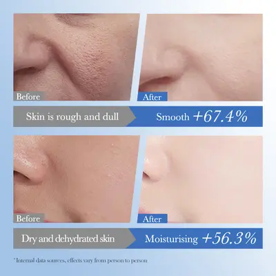 BIOAOUA Seramid Hyaluronik Asit Nemlendirici Serum