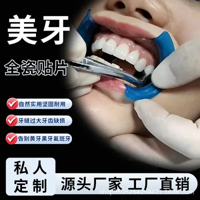 Yiohjia All-Ceramic Dental Veneer Porcelain Laminate, Blue Ceramic, Amber Ceramic, Lingxi Ceramic, Handmade Porcelain, Fluorosis Teeth Whitening Teeth - 1