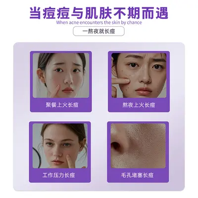 Microcrystalline Hydrocolloid Acne Patch, Thin and Invisible