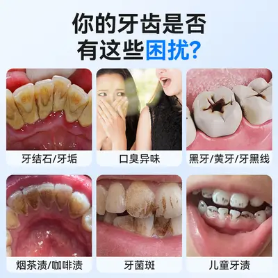 Ultrasonic Dental Scaler and Water Flosser for Home Tartar Removal