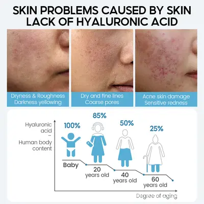 GLAMOUR Hyaluronik Asit Serum 15 ml, Nemlendirici