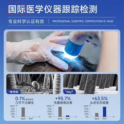 Selenium Disulfide Shampoo Anti-Dandruff and Oil Control - 4