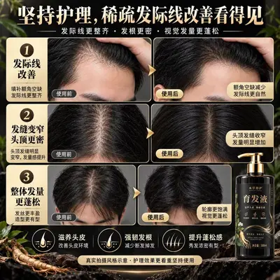 Polygonum Multiflorum Ginseng Anti-Hair Loss Serum, Scalp Care Essence
