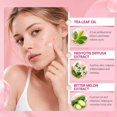 Heart and Round Hydrocolloid Pimple Patches, Pus-Absorbing and Makeup-Compatible - 4