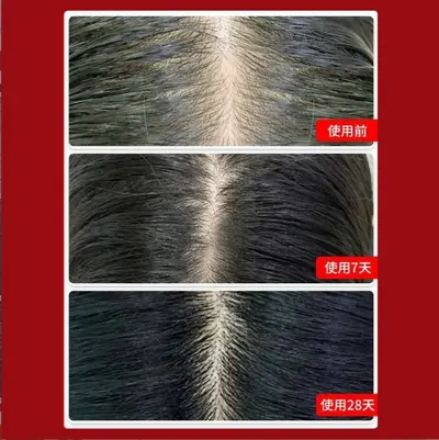 Haarausfall-Serum, Haarwurzel-Stärkungspflegeöl - 4