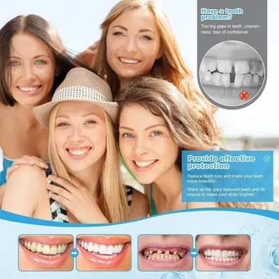 HOMTOPY Silicone Denture Veneer Set, Whitening Smile Teeth Covers - 5