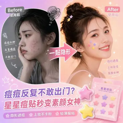 Medical Grade PE Star Acne Patch, Microneedle Pus-Absorbing Hydrocolloid Pimple Patch - 3