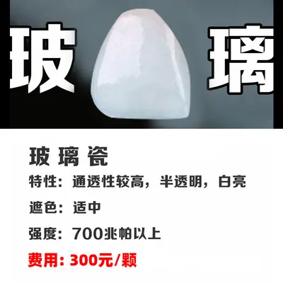 Full Porcelain Dental Veneers, Domestic Porcelain Tooth Veneer Patches - 9